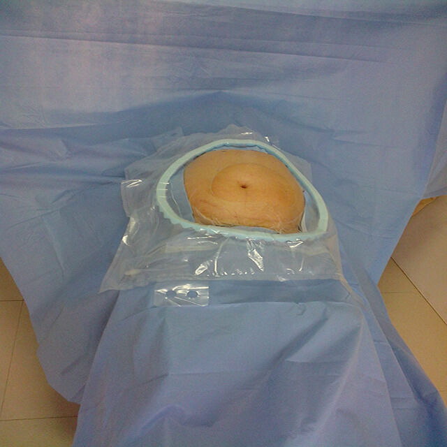 উচ্চ শোষণ ক্ষমতা সহ শক্তিশালী শোষণকারী সমালোচনামূলক অঞ্চল এবং হাসপাতালের জরুরী অবস্থার জন্য ইও নির্বীজন সহ একক সার্জিক্যাল প্যাক